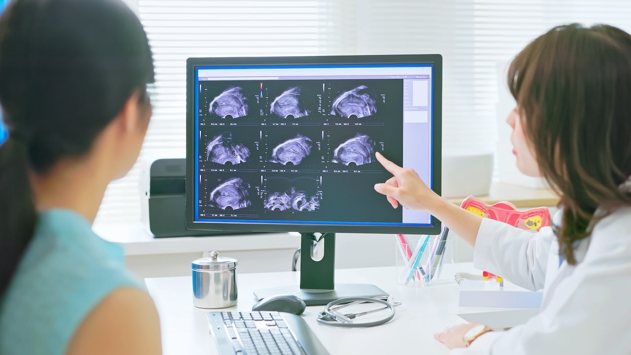 ai-ovarian-cancer-detection