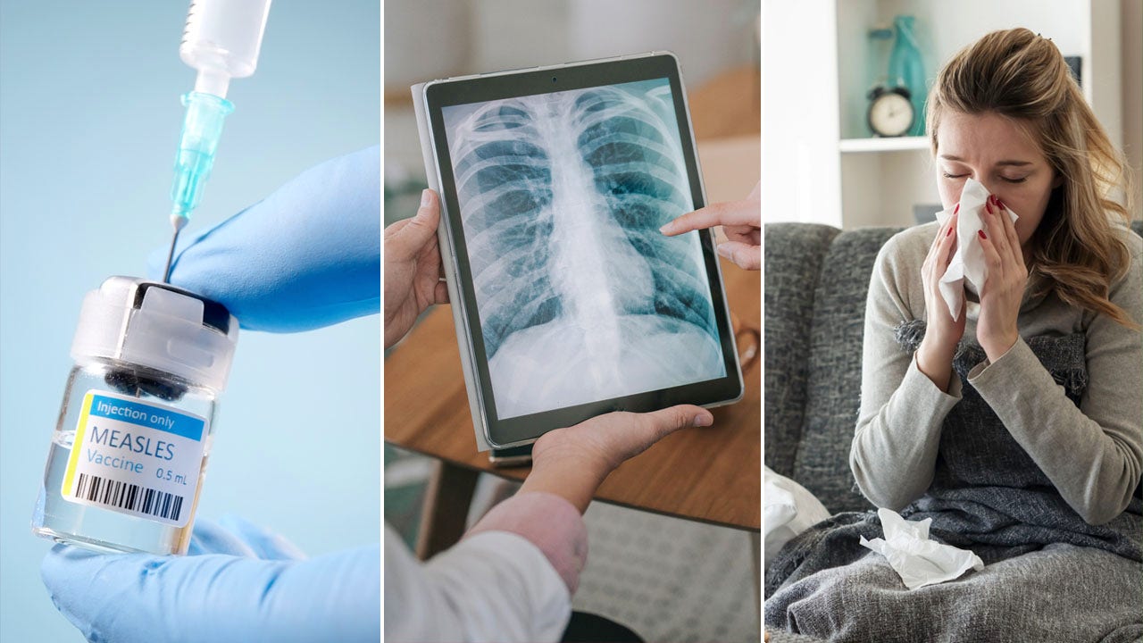 flu-cases-measles-cancer-trends