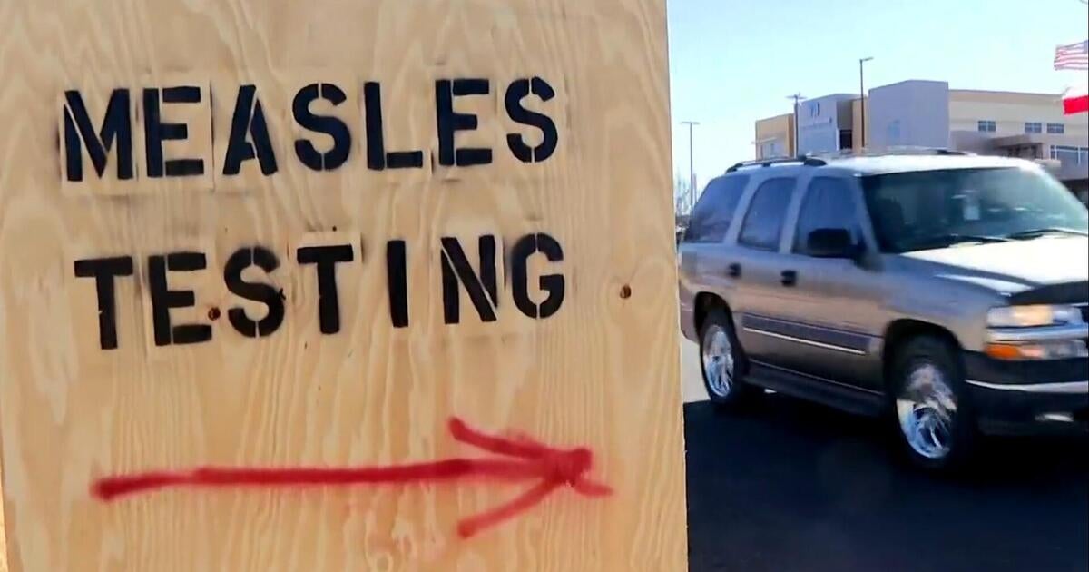 texas-measles-outbreak