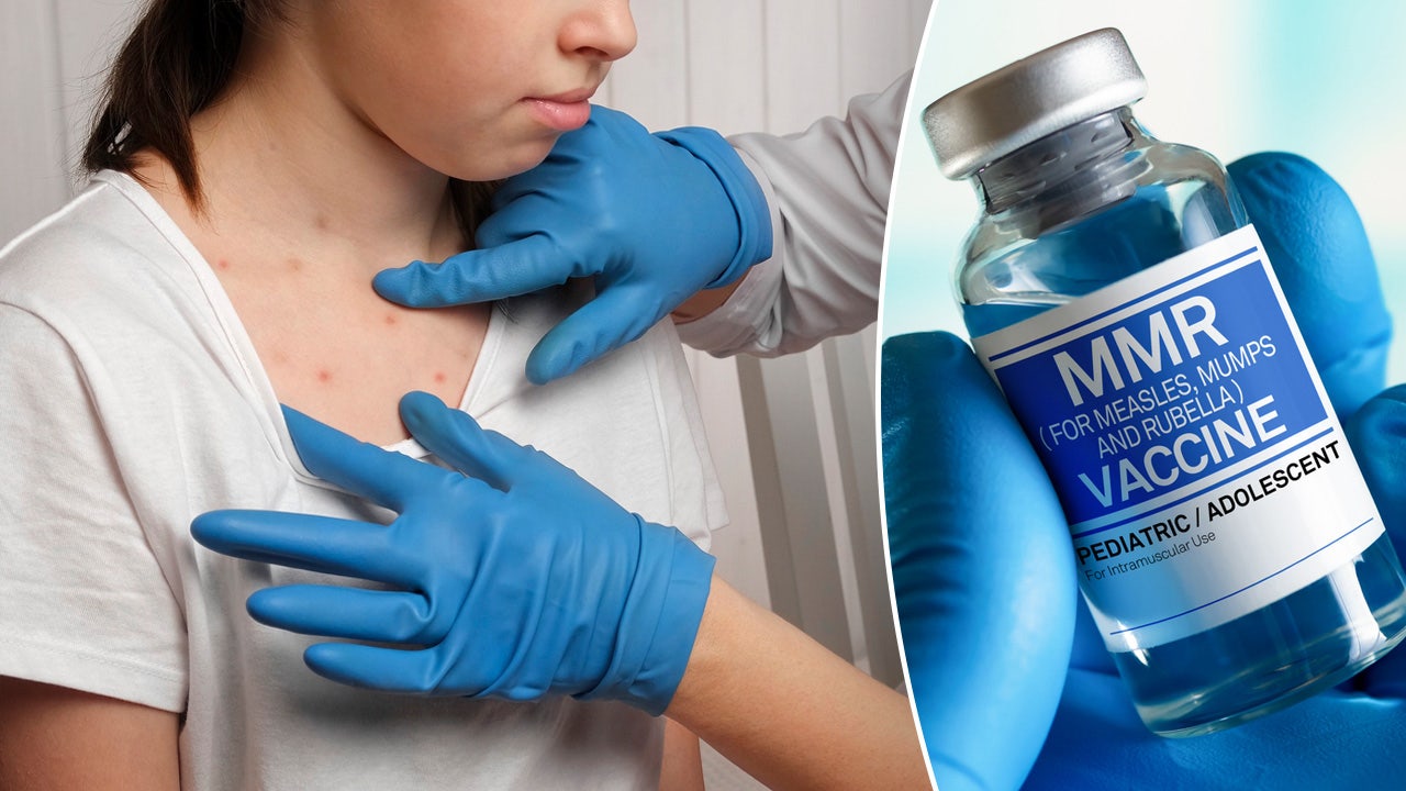 texas-measles-outbreak