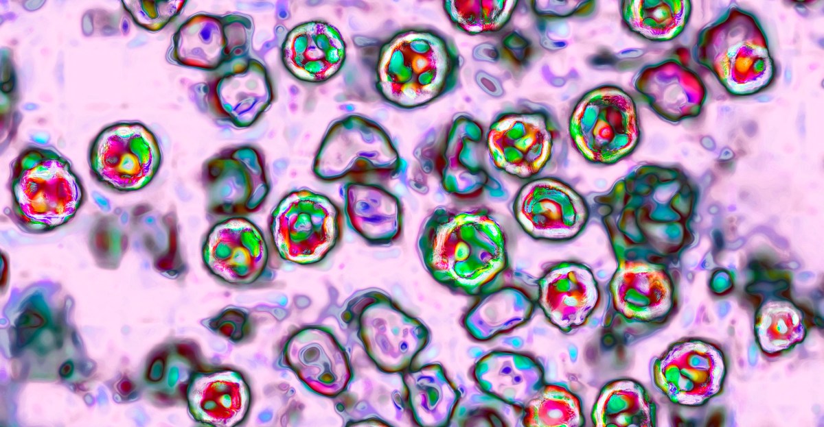 measles-vaccine-myths