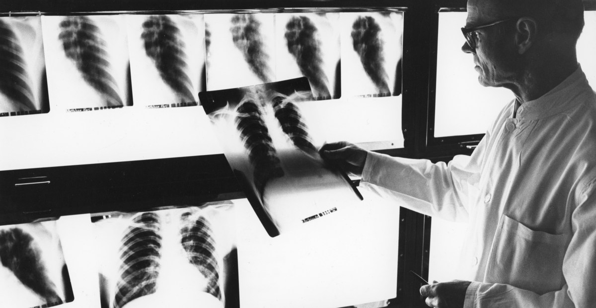 tuberculosis-epidemic-lives-lost