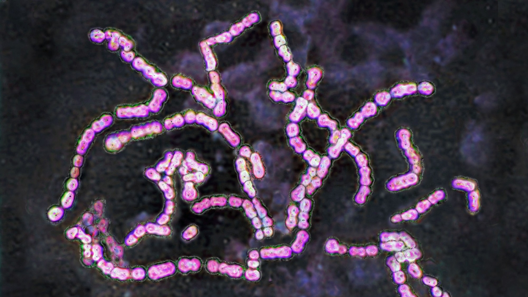 strep-infections-rise-us