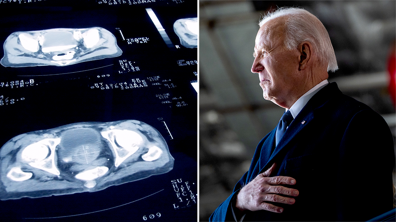 gleason-score-prostate-cancer-biden