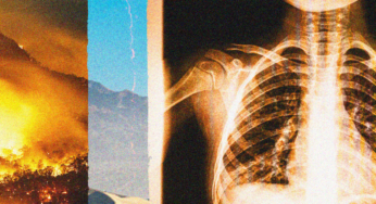 Rising Risks: How Climate Change is Amplifying Valley Fever Threats in California